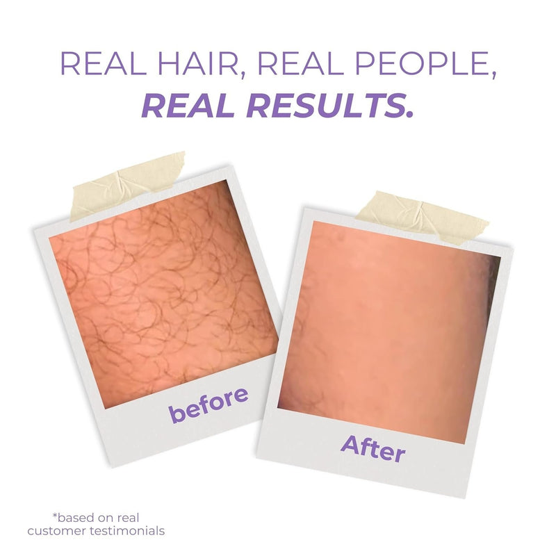 Crystal Hair Eraser™ (Random Colour)